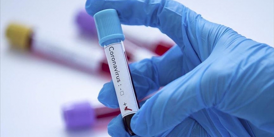 Dünya Genelinde Kovid-19 Bulaşan Kişi Sayısı 2 Milyon 184 Bini Geçti