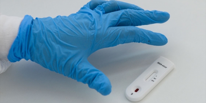 Dünya Genelinde Kovid-19 Vaka Sayısı 2 Milyon 200 Bini Aştı