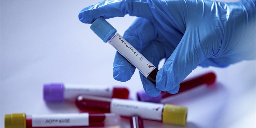 Cumhurbaşkanlığı Kültür Ve Sanat Politikaları Kurulundan Koronavirüsle İlgili Türkçe Kelime Önerileri