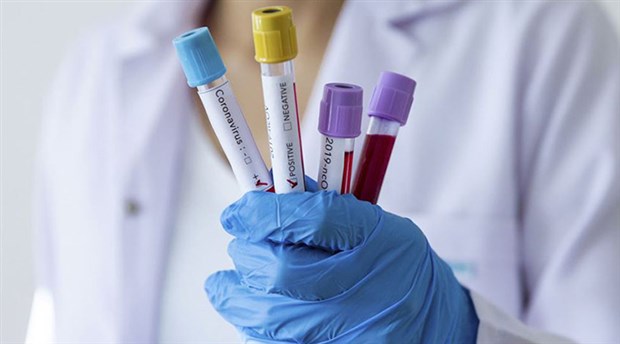 Singapur Teknoloji Üniversitesi COVID-19 Pandemisinin Ne Zaman Bitecek, duyurdu