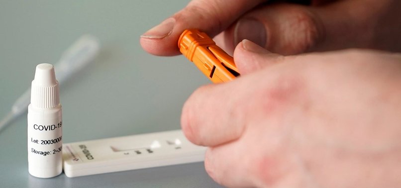 İngiltere resmen açıkladı! 20 dakikada sonuç veriyor.