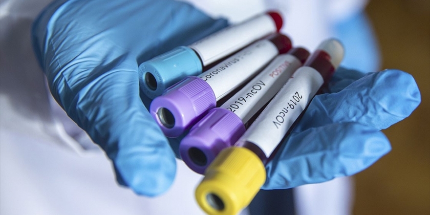 Tacikistan'da İlk Koronavirüs Vakaları Tespit Edildi