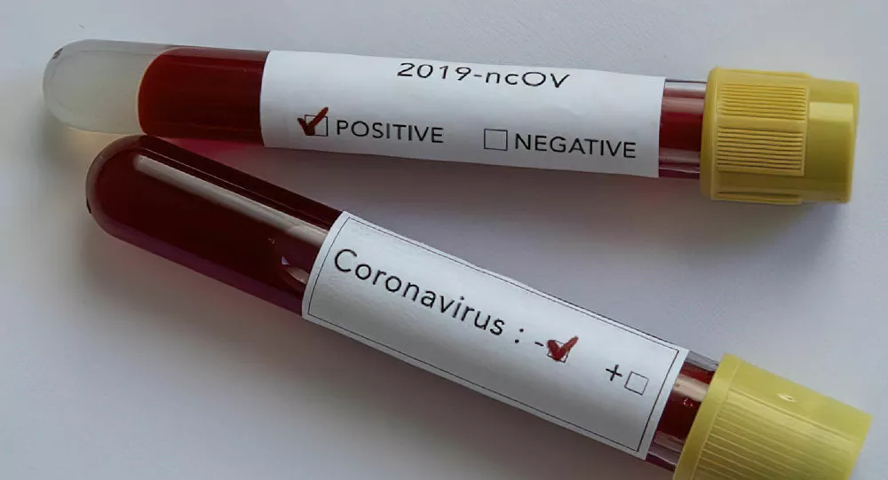 Türkiye'de koronavirüs kaynaklı can kaybı 3174'e yükseldi: Son 24 saatte 93 kişi hayatını kaybetti