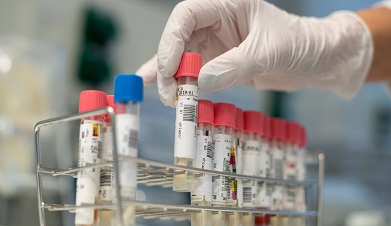 Prof. Ceyhan: Vaka sayısını düşürmek için uğraşmalıyız, yüzmüş yüzmüş kuyruğuna gelmiş değiliz