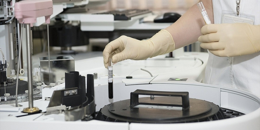 Araştırma: Kovid-19, 2019 Sonunda Dünyada Hızla Yayılmaya Başlamış Görünüyor