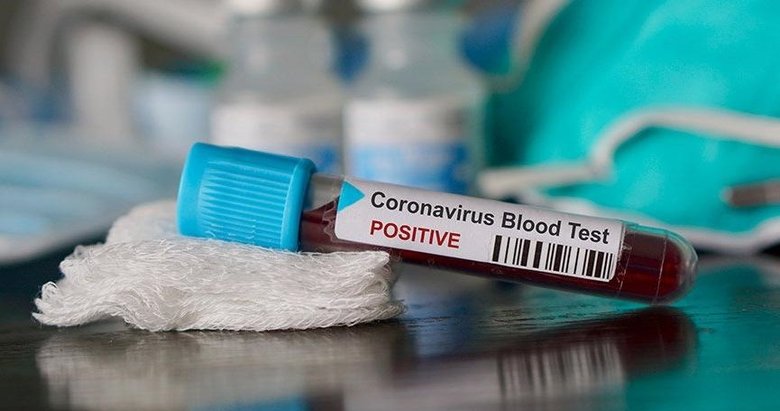 150 bin kişiye bağışıklık testi yapılacak