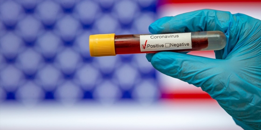 Abd'de 'Evde Kovid-19 Testine' Onay