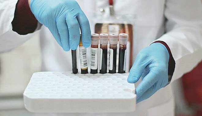 İki dev şirket korona virüs aşısı için tarih verdi