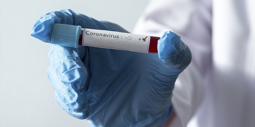 Kasımpaşa Kulübü'nde İki Kişide Kovid-19 Tespit Edildi