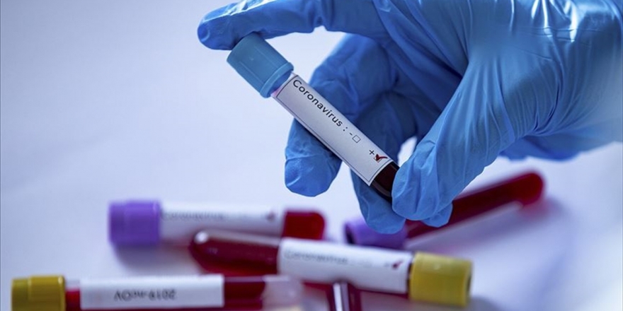 Türkiye'de Son 24 Saatte 1615 Kişinin Daha Kovid-19 Tedavisi Tamamlandı