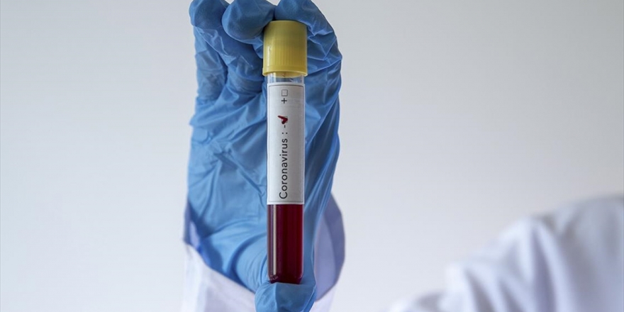 Beşiktaş'ta Kovid-19 Testleri Negatif Çıktı