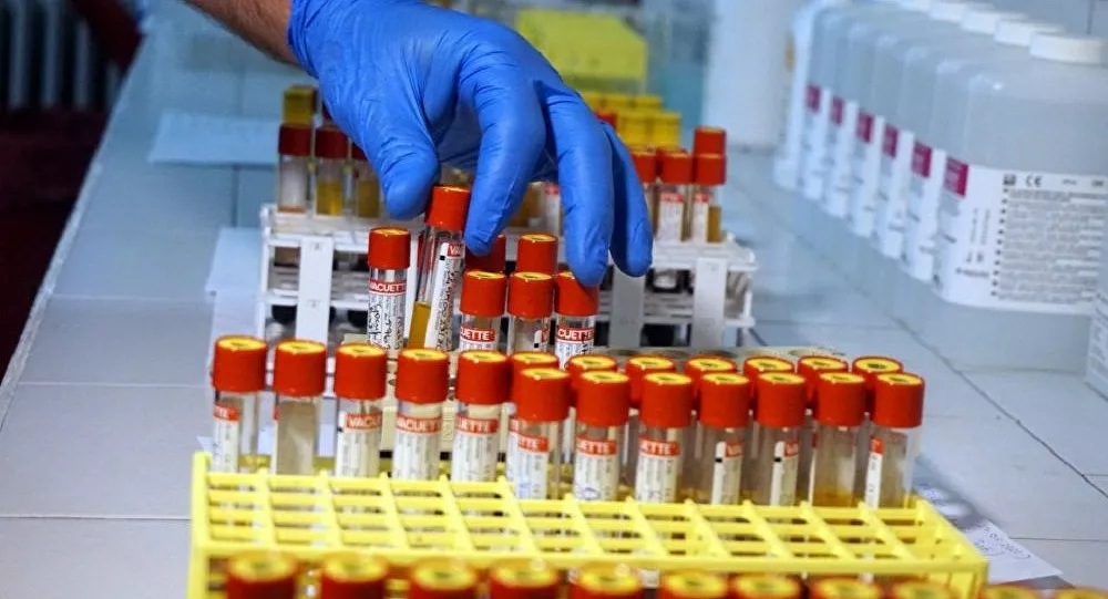 Koronavirüs testine gitmek istemeyen genç kız kendisini odasına kilitledi