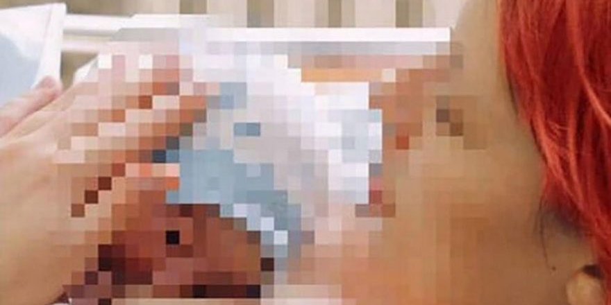 Rusya'da 13 yaşındayken 10 yaşındaki çocuktan hamile kalan kız erken doğum yaptı