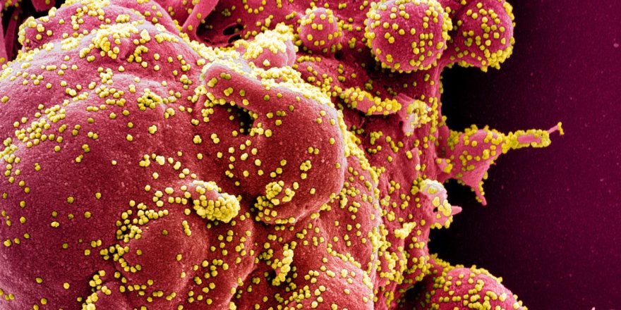 T Hücreleri Corona Virüsüne Yanıt Olabilir mi?