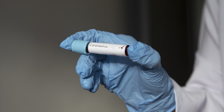 DSÖ: Kovid-19'a İkinci Kez Yakalanılması Konusunda Tam Bir Cevabımız Yok