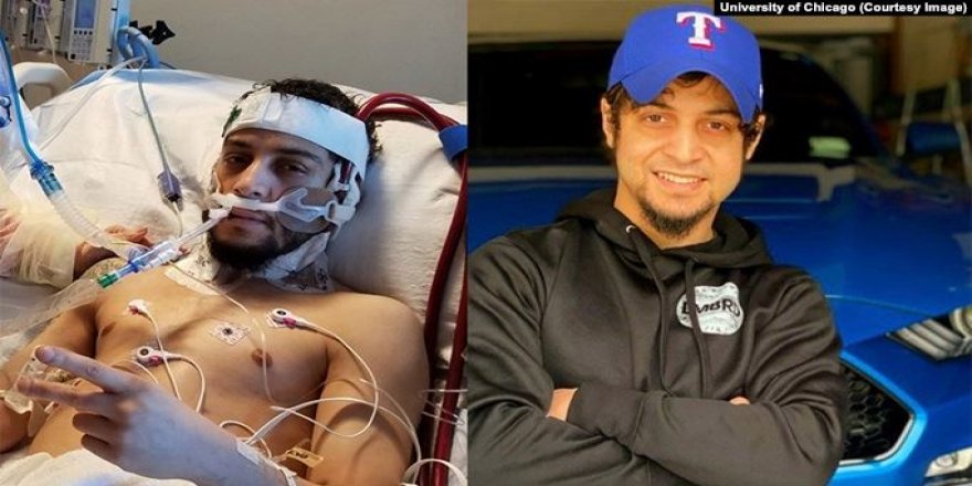 Corona Virüsüne Yakalanan Akciğer Nakli Hastası Nasıl İyileşti?