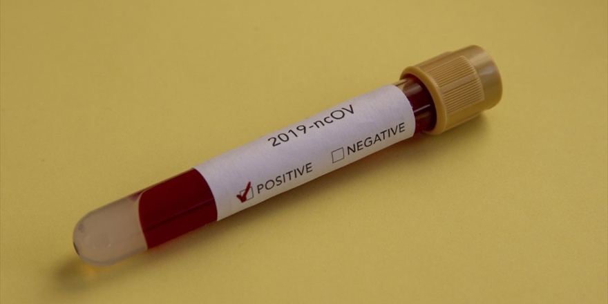 Florida'da Kovid-19'a Yakalanan Çocukların Oranı Yüzde 34 Arttı