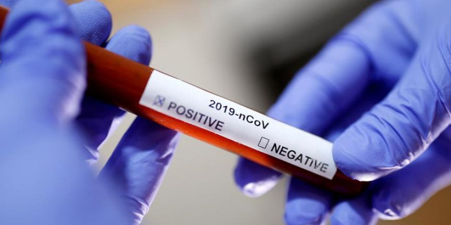 Düğünde aynı makyaj malzemesini kullanan 35 kişiye Koronavirüs bulaştı!