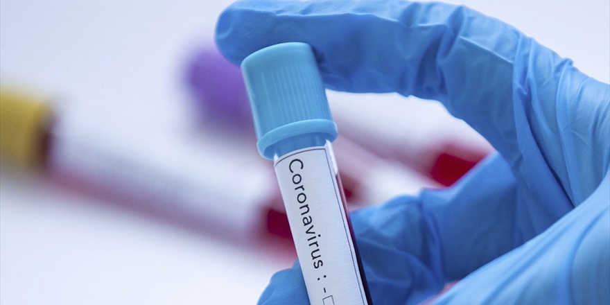 Risk Grubundaki Çalışanlar 'Kovid-19 İdari İzin Tanısı' Raporuyla İzinli Sayılabilecek