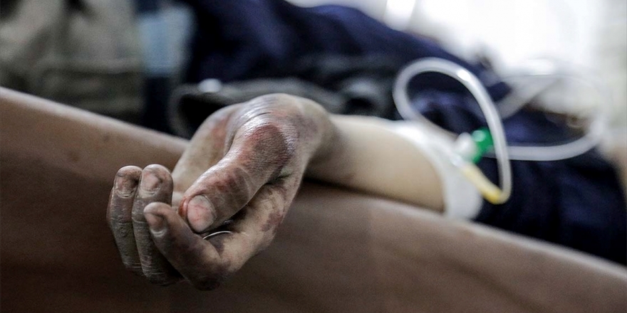 Hama'da Esed Rejimine Bağlı Hastanelerdeki Serumlar Zehir Saçıyor