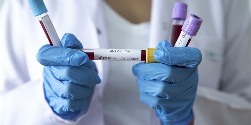 Bilim İnsanından 'İkinci Kovid-19 Tanısında Bulaştırıcılık İncelenmeli' Talebi