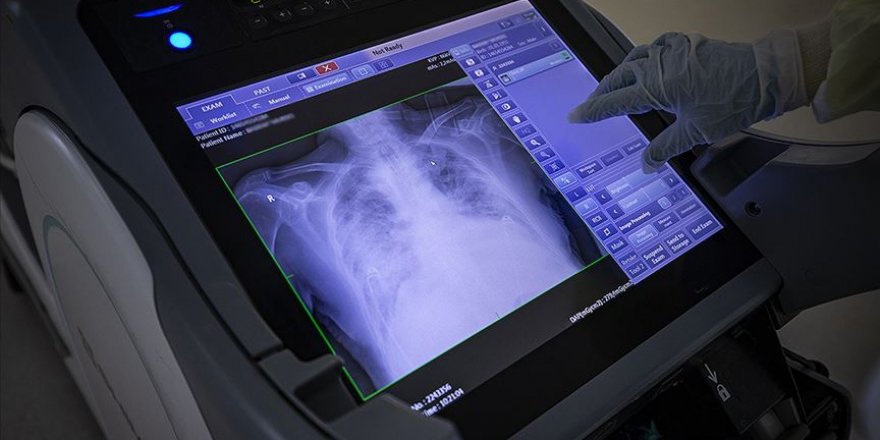 Koca, Türkiye'de En Çok Vaka Görülen İli Açıkladı