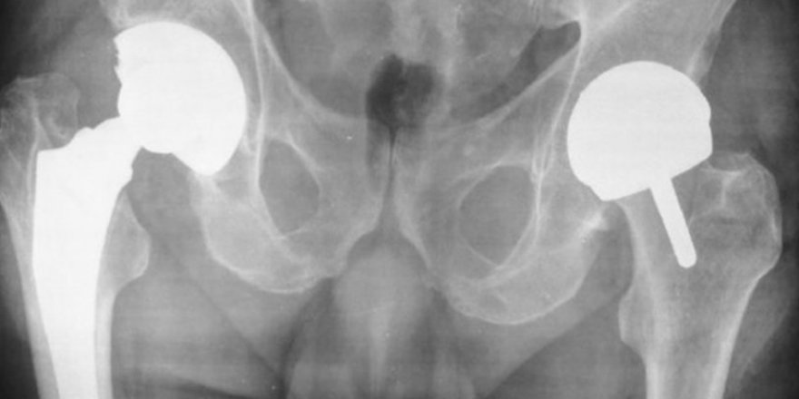 Ünlü Cerrahın Hastalarından Aldığı Kemikler Ortaya Çıktı!