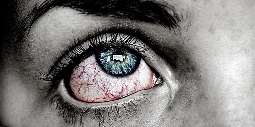 Koronavirüs Belirtileri Gözlerde De Görülebiliyor