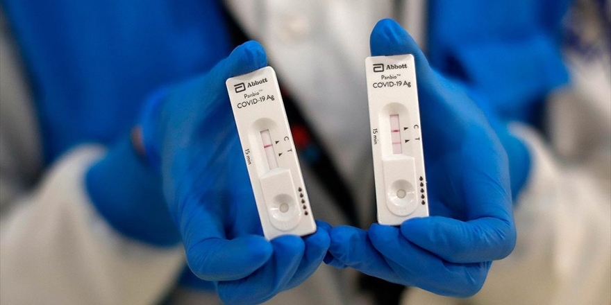 Dünya Genelinde Kovid-19 Tespit Edilen Kişi Sayısı 37 Milyon 475 Bini Geçti