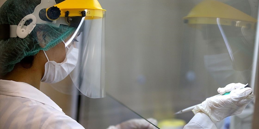 Türkiye'de Son 24 Saatte 1614 Kişiye Kovid-19 Tanısı Kondu, 58 Kişi Hayatını Kaybetti