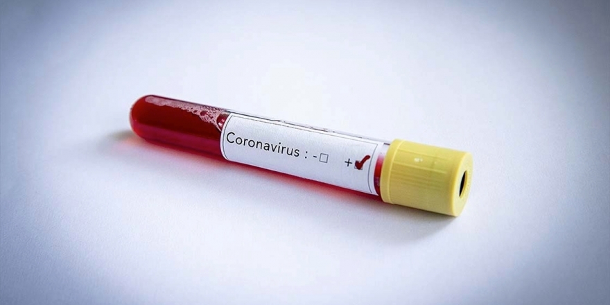 Temasta Bulunduğu Kişileri Bildirmeyen Kovid-19 Hastası Hakkında Soruşturma