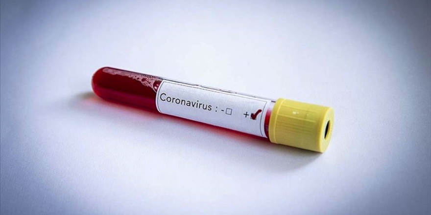 DSÖ: Kovid-19 Tedavisinde Tek Etkili İlaç 'Deksametazon'