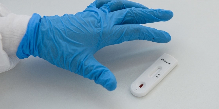 Kovid-19 Sonrası Antikor Seviyelerinin 'Hızla Düştüğü' Ortaya Çıktı