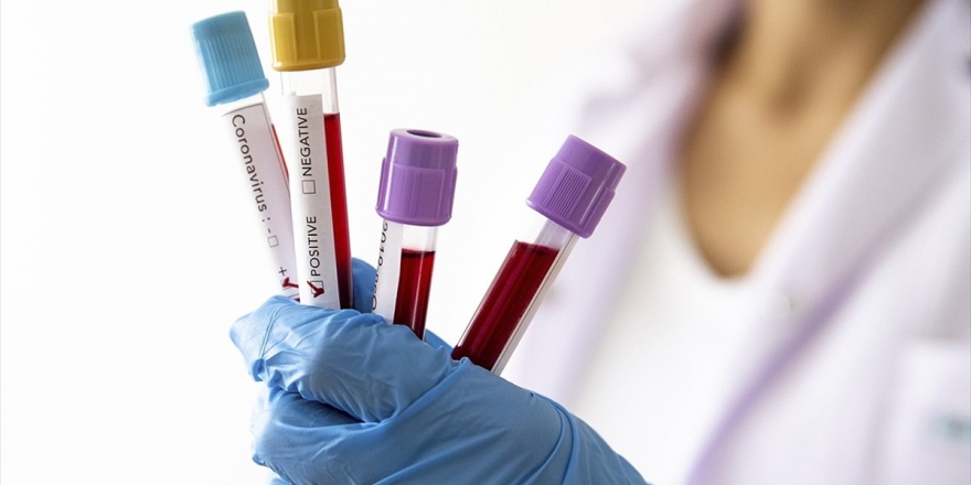 Kovid-19'un Bir Mutasyonu Virüsü Daha Bulaşıcı Hale Getirmiş Olabilir