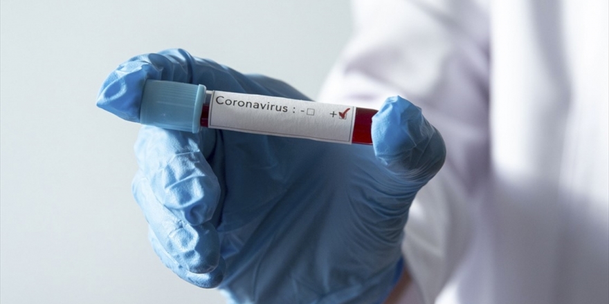 Galatasaray'da Üç Futbolcunun Daha Kovid-19 Test Sonuçları Pozitif Çıktı