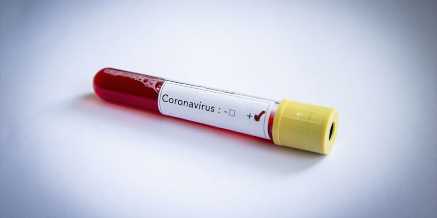 Sivasspor'da 2'si Futbolcu 4 Kişinin Kovid-19 Testi Pozitif Çıktı