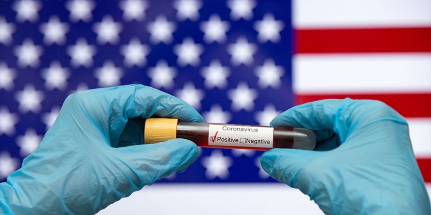 Kan Bağışı Tahlilleri, Abd'de Kovid-19'un Geçen Yıl Aralıkta Yayıldığına İşaret Ediyor