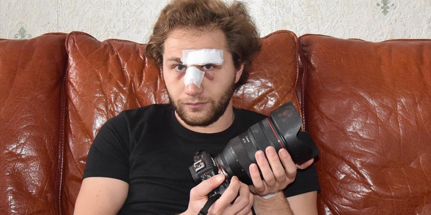 Paris'te Polis Şiddetine Maruz Kalan Suriyeli Gazeteci Al Halbi: Başıma Gelenler Suriye'de Yaşadıklarımı Hatırlattı