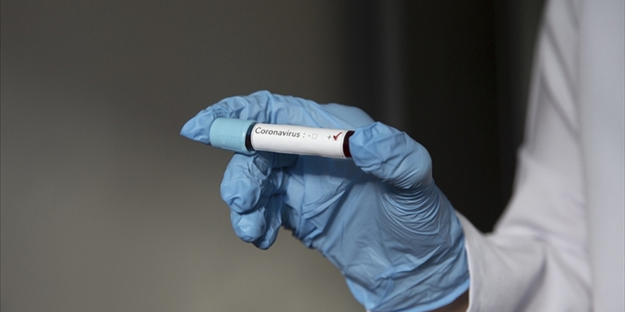 Kovid-19'da Verilen İlaçları Kullanmamak Hastalığın Seyrini Olumsuz Etkiliyor