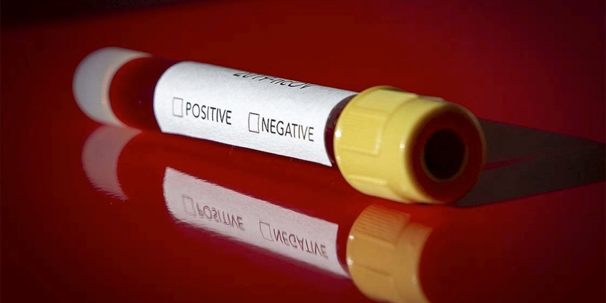 Kovid-19 Takip Merkezleri Açılıyor