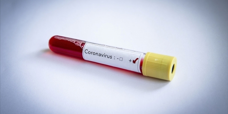 Fenerbahçe'de 3 Futbolcunun Kovid-19 Testinin Pozitif Çıktığı Açıklandı