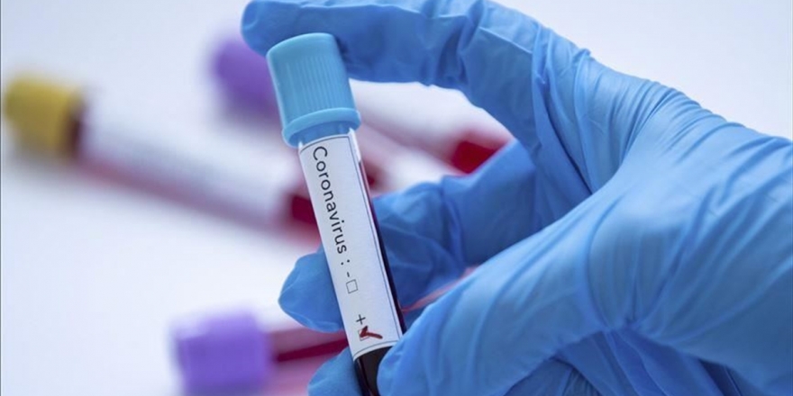 Yeni Koronavirüs Verileri Açıklandı