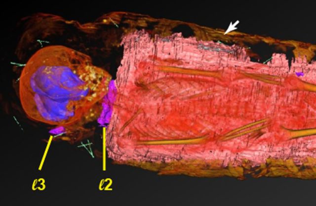 Antik Mumyanın X-Ray Taraması Beklenmedik Bir Keşfi Ortaya Çıkardı