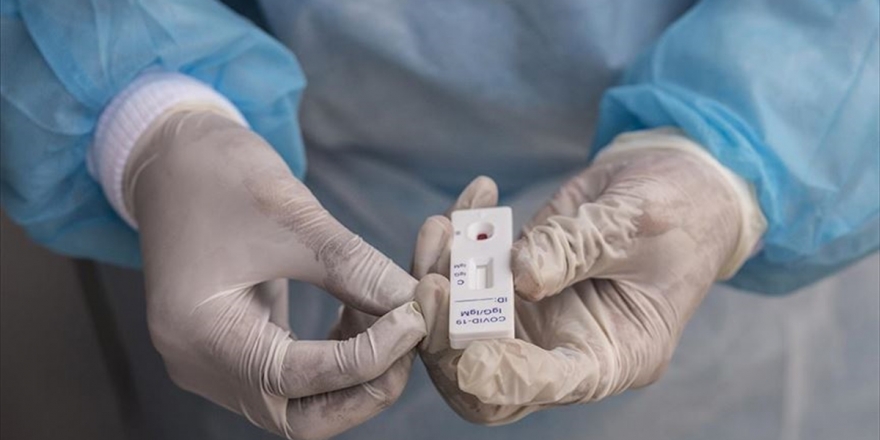 Tacikistan'da 8 Aydan Bu Yana İlk Defa Kovid-19 Vakası Saptanmadı