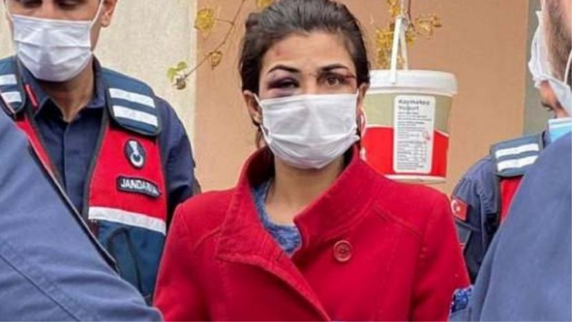 Antalya'da kendisini darbeden kocasını öldüren kadın tutuklandı