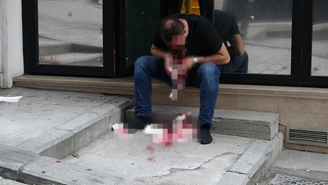 Elindeki tabanca ateş aldı, mermi çenesinden girip alnından çıksa da sedyeye yürüyerek gitti