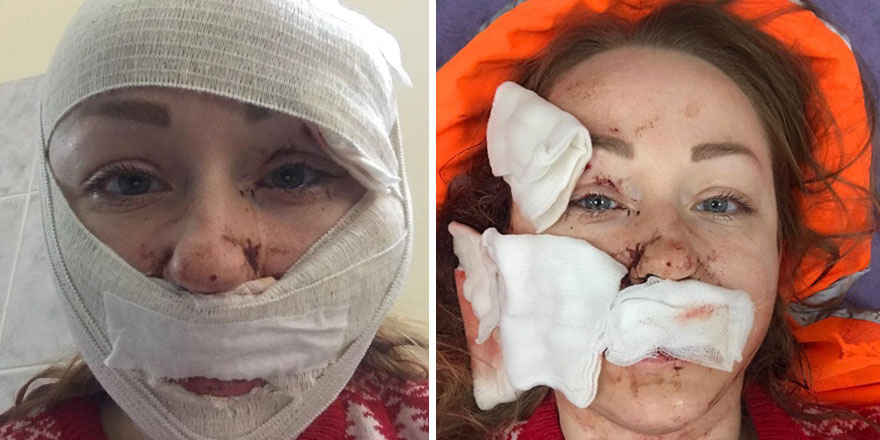 Ayrılmak istediği eşinin falçatalı saldırısına uğradı