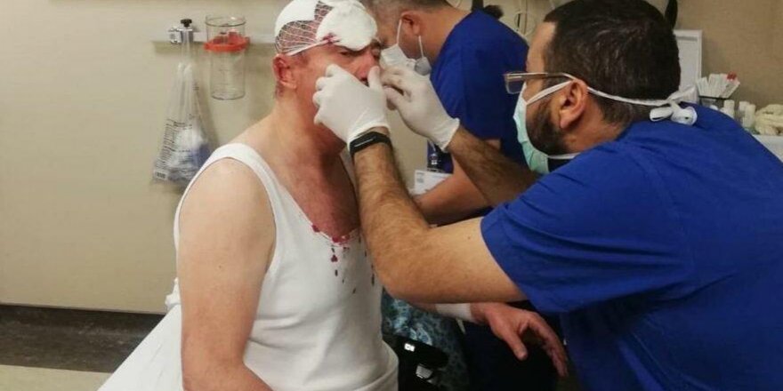 Selçuk Özdağ'a Saldırının Görüntüleri Ortaya Çıktı