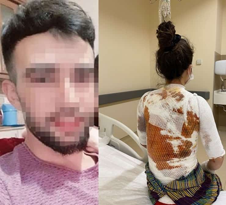 Eşini hastanelik etmişti: İfadesi cezadan kurtulmaya yönelik; kaynar su silah sayılsın