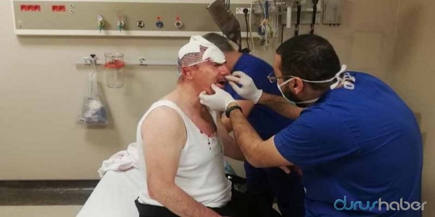 Gelecek Partili Özdağ'a Saldırı Anının Yeni Görüntüleri Çıktı